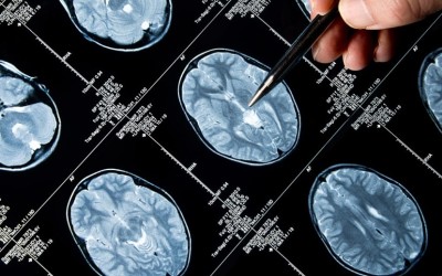 Epigenetics Pioneer Influences Student Research Higher Degrees Northcentral University